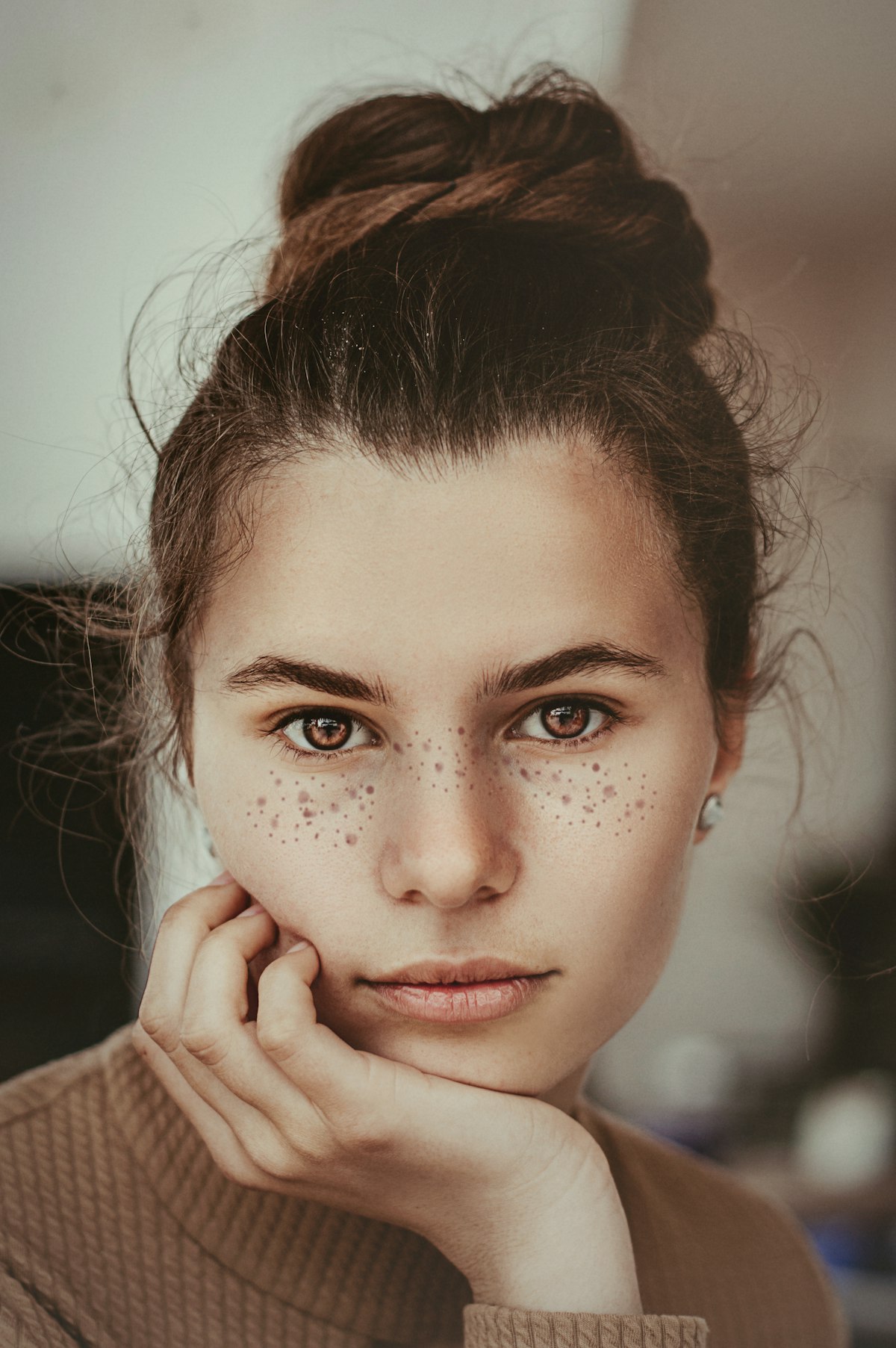 Close-up of facial skin and eye affected by rosacea